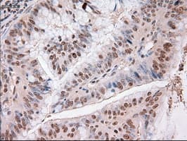 TRIM33 / TIF1-Gamma Antibody (clone OTI9D4)