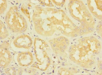 DUSP10 / MKP5 Antibody