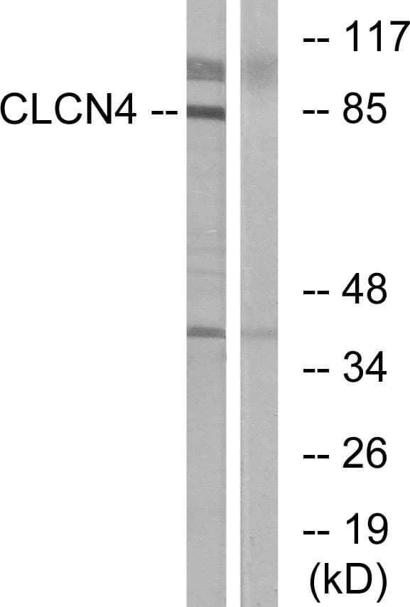 Polyclonal Rabbit anti-Human CLCN4 / CLC-4 Antibody (aa221-270, IF, WB)