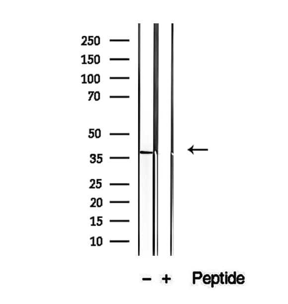 STBD1 Antibody