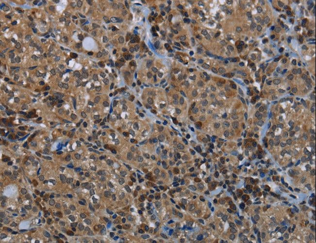 Polyclonal Rabbit anti-Human GYS1 / Glycogen Synthase Antibody (IHC, WB)
