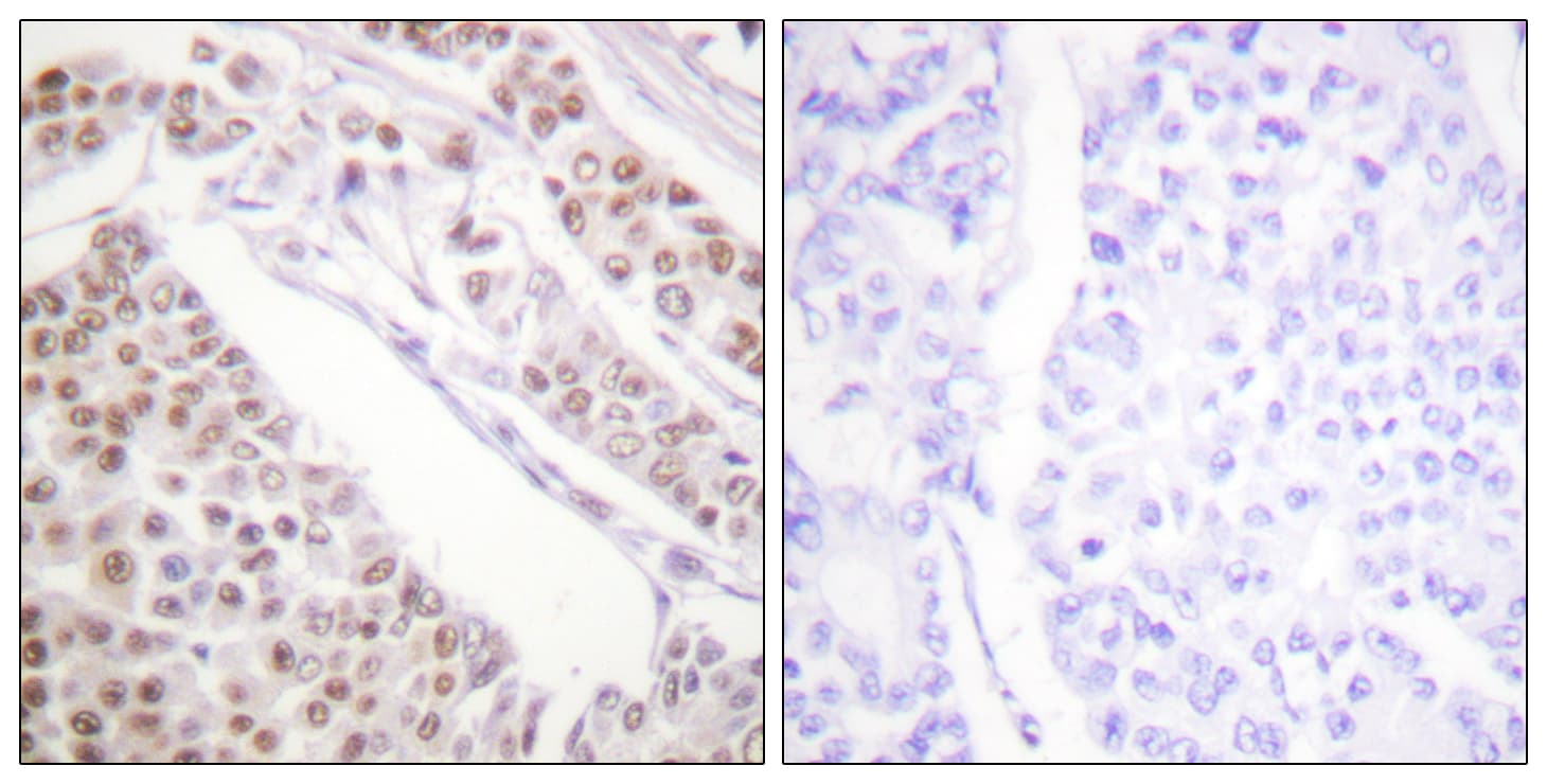 Histone H2B Antibody (Acetyl-Lys12)