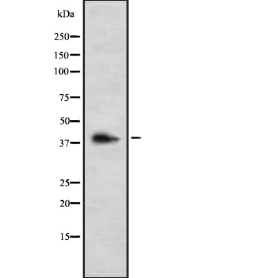 Polyclonal Rabbit anti-Human GALR3 / Galanin Receptor 3 Antibody (IHC, WB)