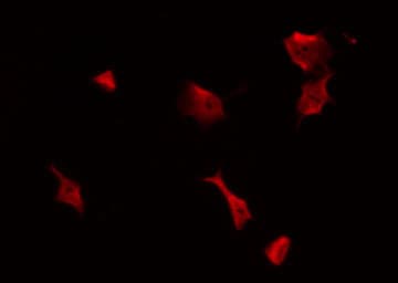 FAK / Focal Adhesion Kinase Antibody