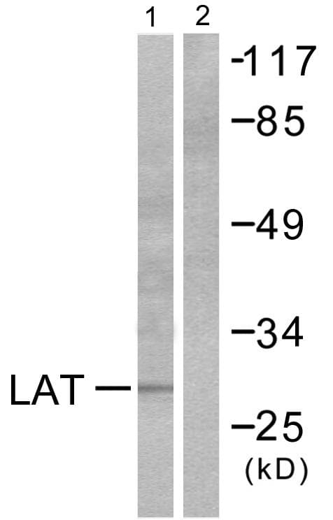 LAT Antibody (p191)