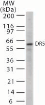 IHC-plus™ TNFRSF10B / Killer / DR5 Antibody (aa388-407)