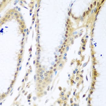 MYBBP1A Antibody