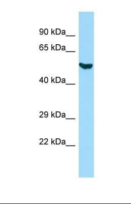 Polyclonal Rabbit anti-Human KRT8 / CK8 / Cytokeratin 8 Antibody (aa198-246, IHC, WB)