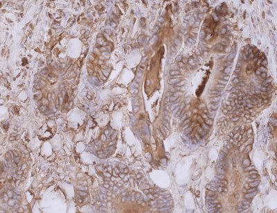 CEACAM5 / CD66e Antibody (clone CB30)