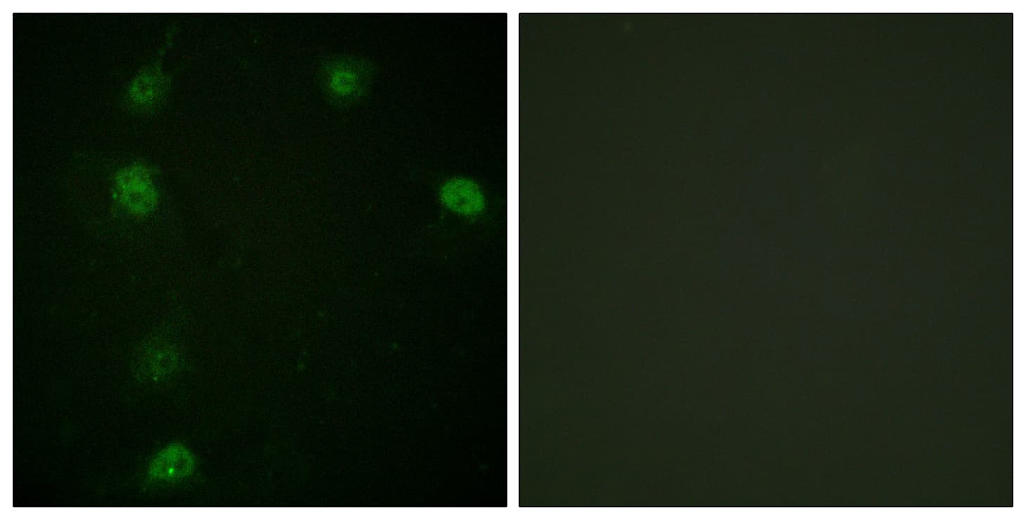 CCNE1 / Cyclin E1 Antibody (phospho-Thr77)