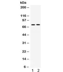 TF / Transferrin Antibody