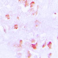 CKM / Creatine Kinase MM Antibody (N-Terminus)