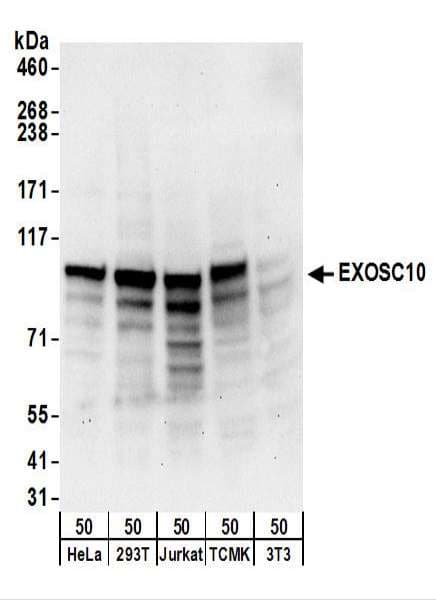 Polyclonal Rabbit anti-Human EXOSC10 Antibody (aa200-250, IHC, WB)