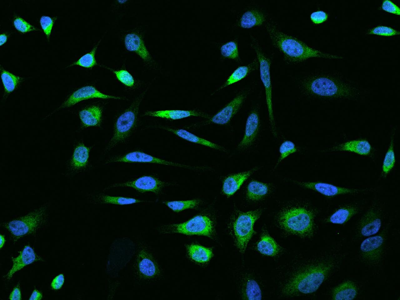 GPNMB / Osteoactivin Antibody