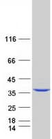Human AGMAT Protein (Recombinant Myc-DDK (Flag))