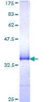Human MARCH5 Protein (Recombinant GST, N-terminus)