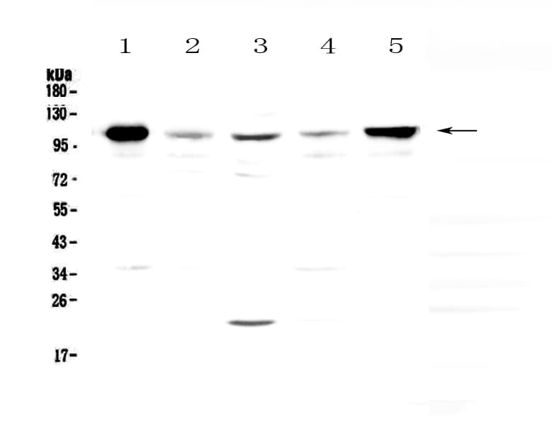VCAM1 / CD106 Antibody