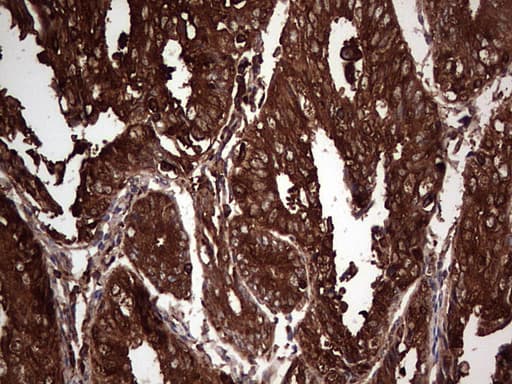 PKM2 Antibody (clone 1G10)