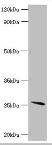 Polyclonal Rabbit anti-Human GSTA2 Antibody (aa1-222, IHC, WB)