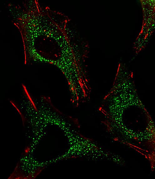 CTSD / Cathepsin D Antibody