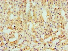 CAMK1G / CaMKI gamma Antibody (aa217-476)