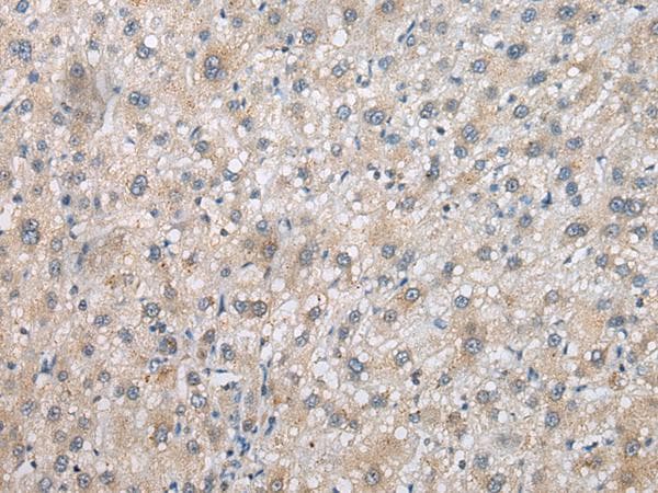 Polyclonal Rabbit anti-Human PSMF1 Antibody (IHC, WB)