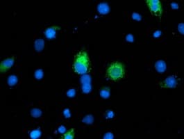 ILVBL Antibody (clone OTI8B12)