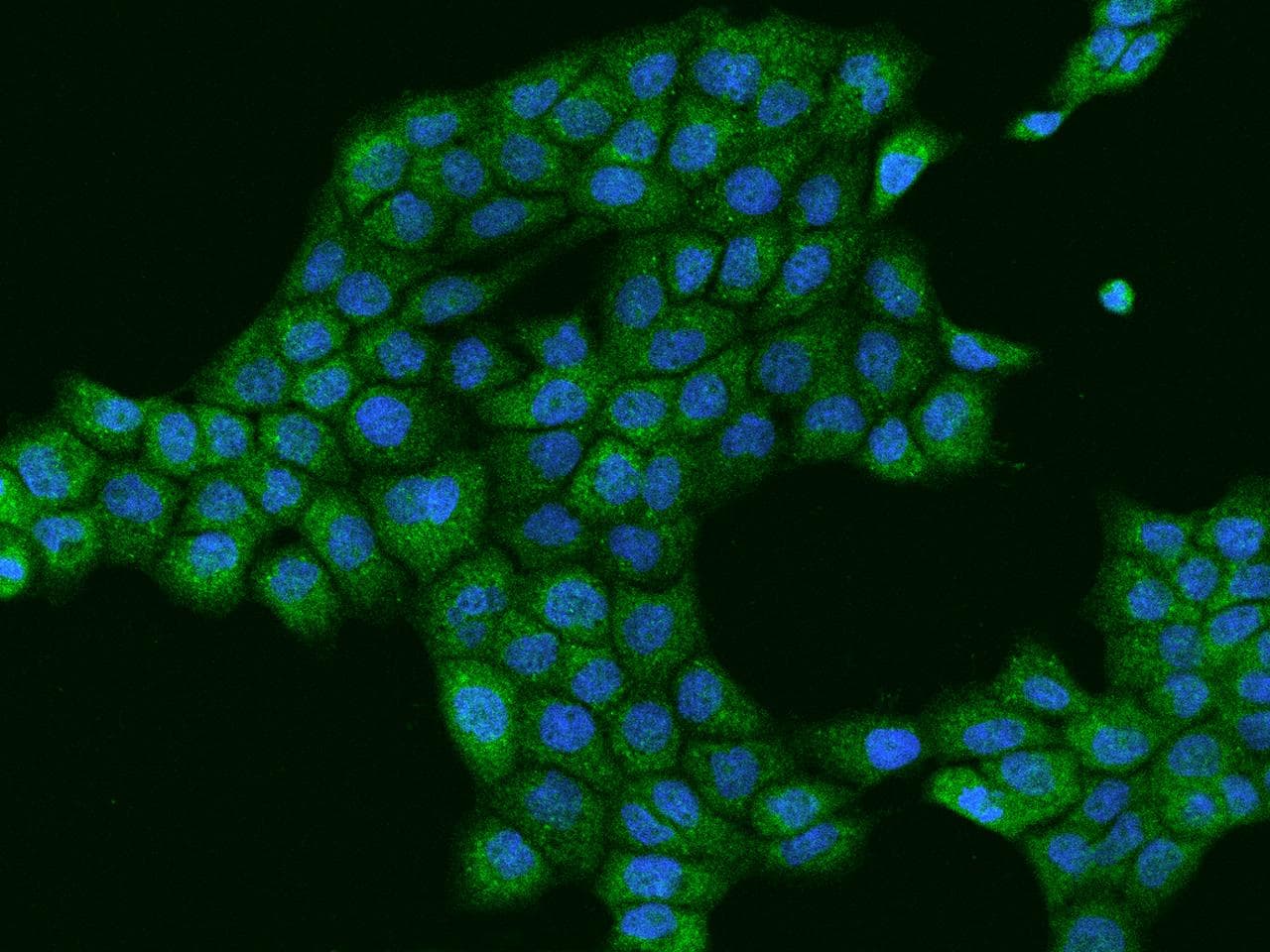 MYO9B Antibody
