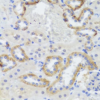 SYNPO / Synaptopodin Antibody