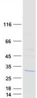 Human LSM12 Protein (Recombinant Myc-DDK (Flag))