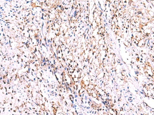 GMDS / GMD Antibody
