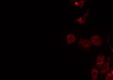 CLC-7 / CLCN7 Antibody