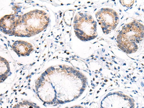 Polyclonal Rabbit anti-Human ANAPC15 Antibody (IHC)