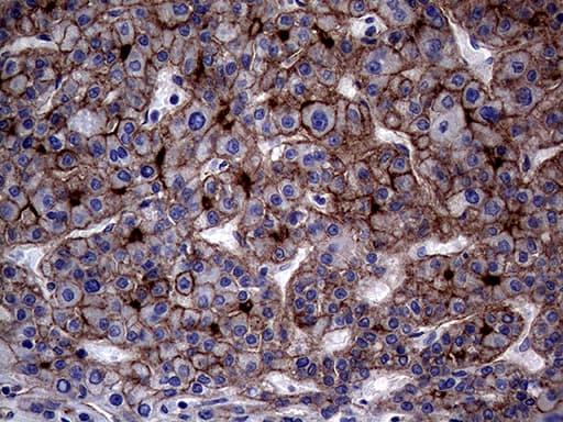 Monoclonal Mouse anti-Human ABCB1 / MDR1 / P Glycoprotein Antibody (clone OTI16D9, aa995-1280, IHC, WB)