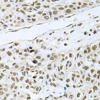 Polyclonal Rabbit anti-Human MCL1 / MCL 1 Antibody (IHC, IF, WB)