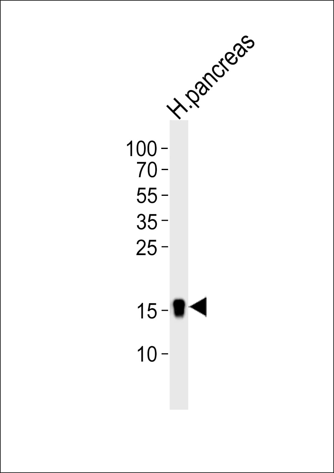 REG3A Antibody (aa129-163)