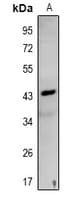 Polyclonal Rabbit anti-Human NDRG3 Antibody (IHC, WB)