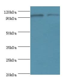 NLGN4Y Antibody (aa682-816)