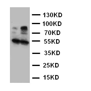 Polyclonal Rabbit anti-Human HSD17B2 Antibody (aa373-387, IHC, WB)