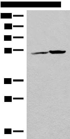 FECH / Ferrochelatase Antibody