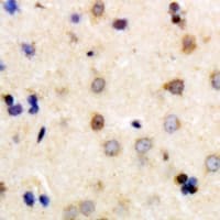 DPP2 / DPP7 Antibody
