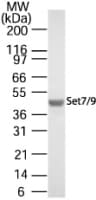 IHC-plus™ Polyclonal Rabbit anti-Human SETD7 / SET7 Antibody (aa131-145, IHC, WB)
