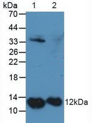 S100A4 / FSP1 Antibody (aa2-101)