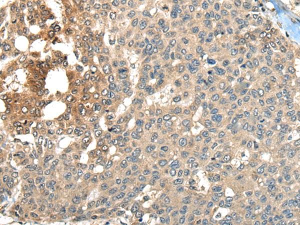 Polyclonal Rabbit anti-Human MAPK4 / ERK4 Antibody (IHC, WB)