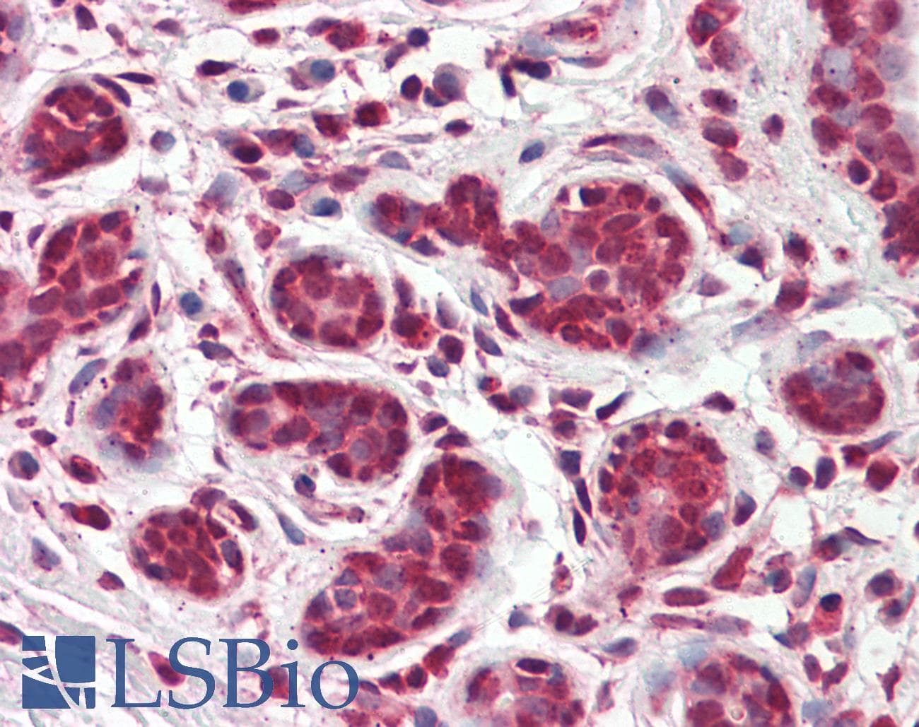 NR1A2 / THRB Antibody