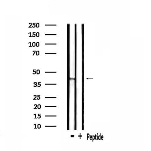 NPBWR2 / GPR8 Antibody