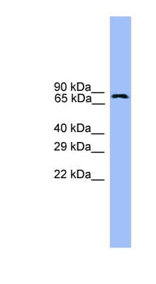 Polyclonal Rabbit anti-Human USP1 Antibody (aa701-750, WB)