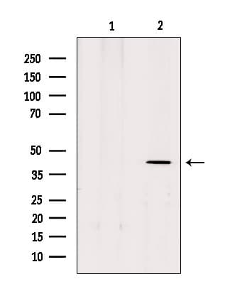 MTNR1B / MT2 Antibody