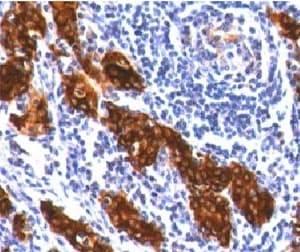 TG / Thyroglobulin Antibody (clone TG157-2)