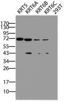 IHC-plus™ KRT5 / CK5 / Cytokeratin 5 Antibody (clone 4H8)